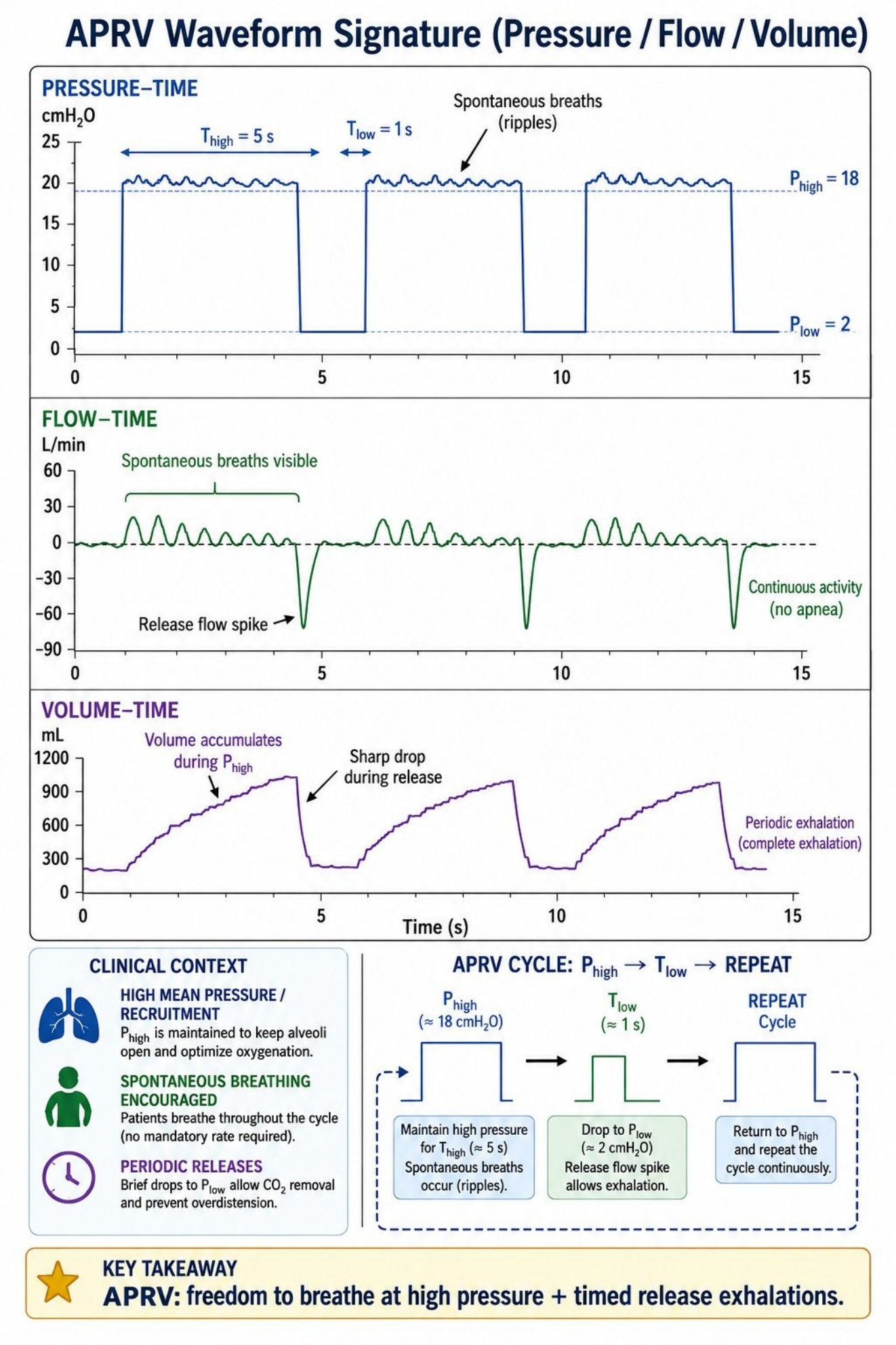 Hình MVG-F13-01. Dấu hiệu đồ họa điển hình của APRV. Nguồn: Mastering Ventilator Graphics, trang PDF 69.